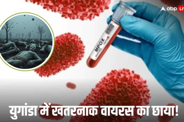 mpox in East African country Uganda has reported 4 deaths in the past 5 days