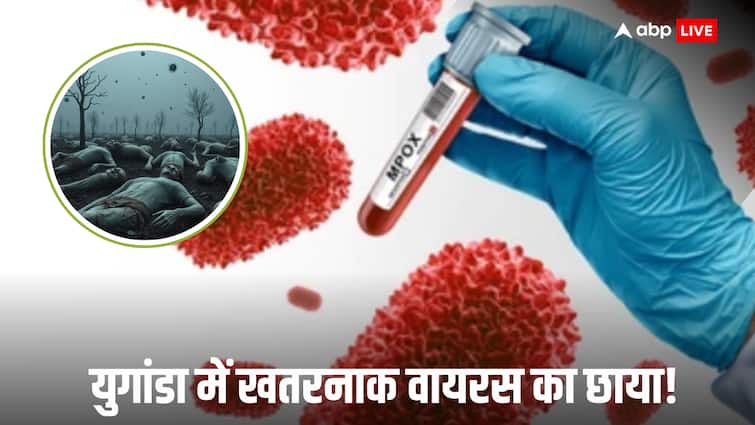 mpox in East African country Uganda has reported 4 deaths in the past 5 days