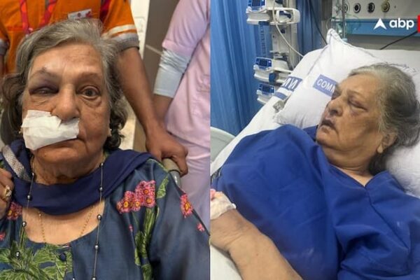 Air India Denied to give Wheelchair to 82 year old women fall in IGI t3 airport Admitted in ICU
