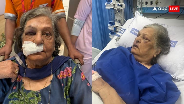 Air India Denied to give Wheelchair to 82 year old women fall in IGI t3 airport Admitted in ICU